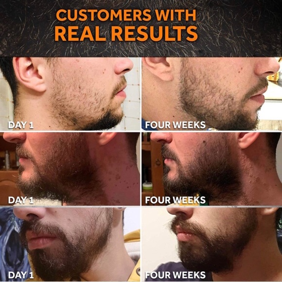 Beard growth maintenance kit-full defined beards - Picture 11 of 11